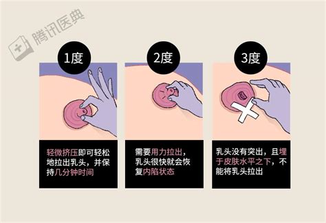 女人的奶頭|形状一人一样 女性乳头的12个秘密